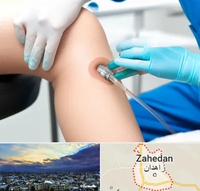 اوزون تراپی در زاهدان
