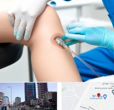 اوزون تراپی در چهارراه طالقانی کرج 