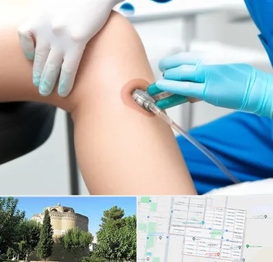 اوزون تراپی در مرداویج اصفهان 