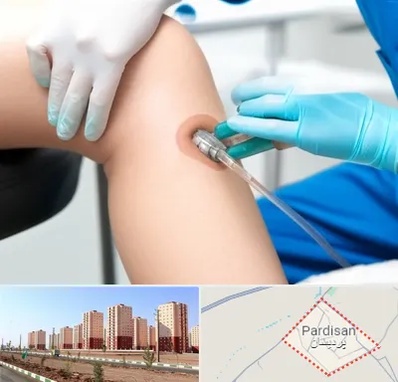 اوزون تراپی در پردیسان قم 