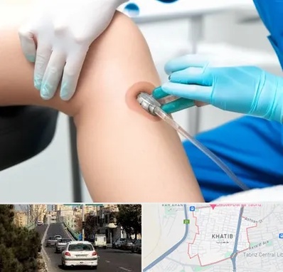 اوزون تراپی در خطیب تبریز 