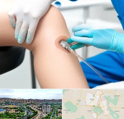 اوزون تراپی در شهریار