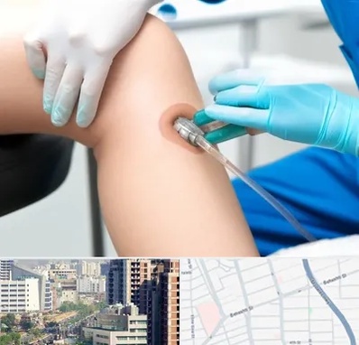 اوزون تراپی در خیابان بهشتی 