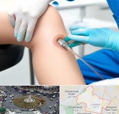 اوزون تراپی در فردیس کرج 