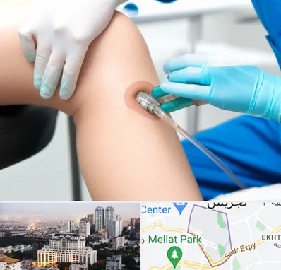 اوزون تراپی در الهیه 