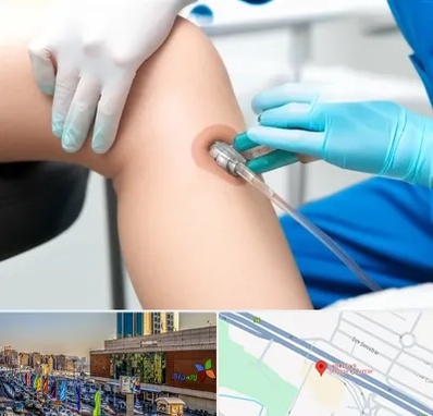 اوزون تراپی در لاله پارک تبریز 