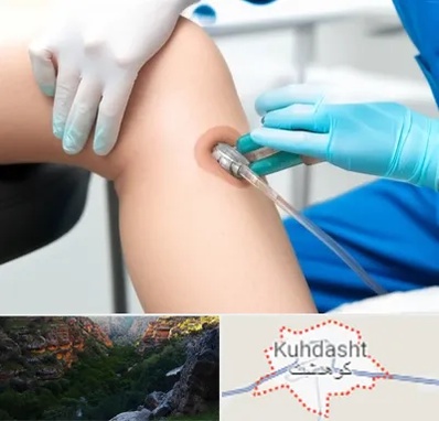 اوزون تراپی در کوهدشت