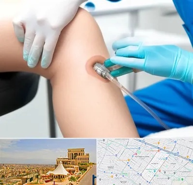 اوزون تراپی در هاشمیه مشهد 