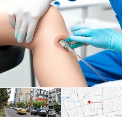 اوزون تراپی در هفده شهریور تبریز 