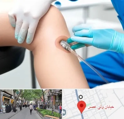 اوزون تراپی در ولیعصر شهریار