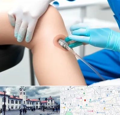 اوزون تراپی در میدان شهرداری رشت 