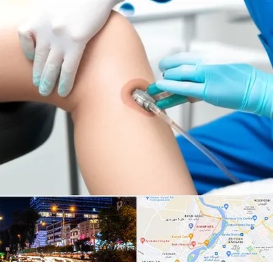 اوزون تراپی در کیانپارس اهواز 