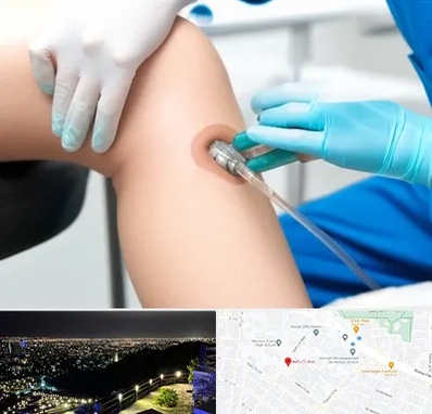 اوزون تراپی در هفت تیر مشهد 