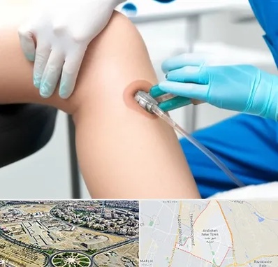 اوزون تراپی در اندیشه