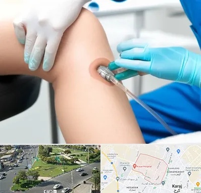 اوزون تراپی در شاهین ویلا کرج 