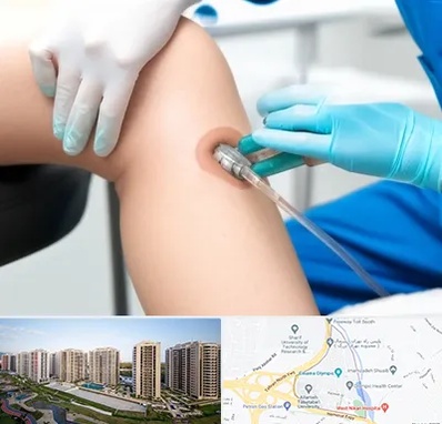 اوزون تراپی در المپیک 