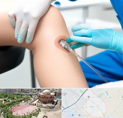 اوزون تراپی در گلستان اسلامشهر 