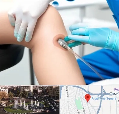 اوزون تراپی در آرژانتین