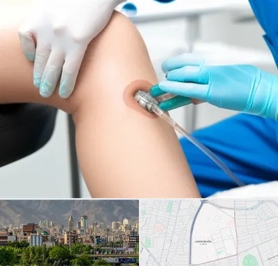 اوزون تراپی در جمشیدیه 