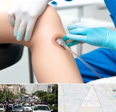 اوزون تراپی در سیدی مشهد 