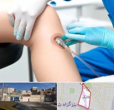 اوزون تراپی در اتابک
