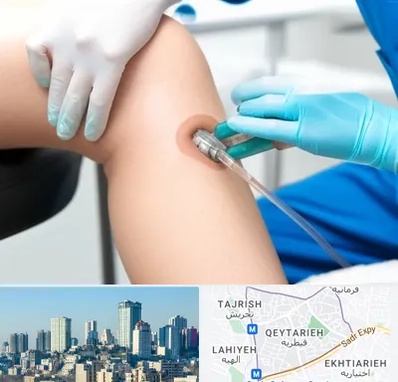 اوزون تراپی در قیطریه 
