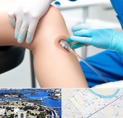 اوزون تراپی در کوروش اهواز 