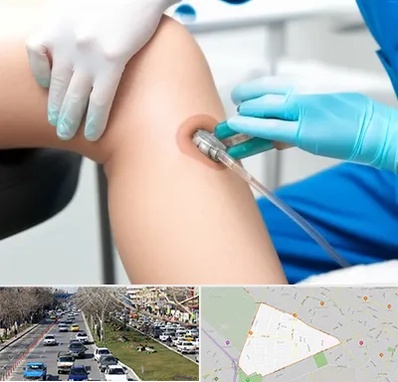 اوزون تراپی در احمدآباد مشهد 