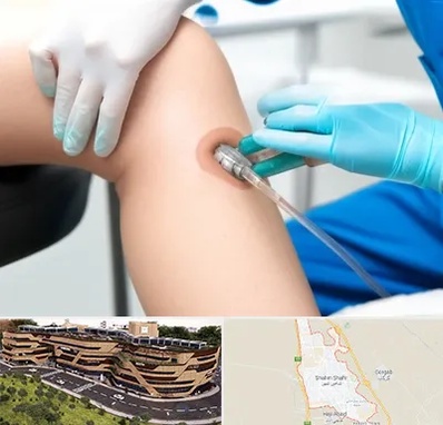 اوزون تراپی در شاهین شهر