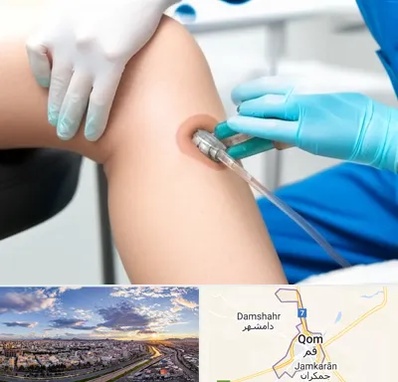 اوزون تراپی در قم