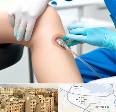 اوزون تراپی در جنوب غرب تهران