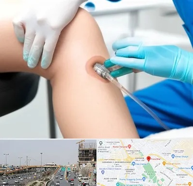 اوزون تراپی در بلوار توس مشهد 