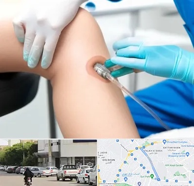 اوزون تراپی در قدوسی شرقی شیراز 