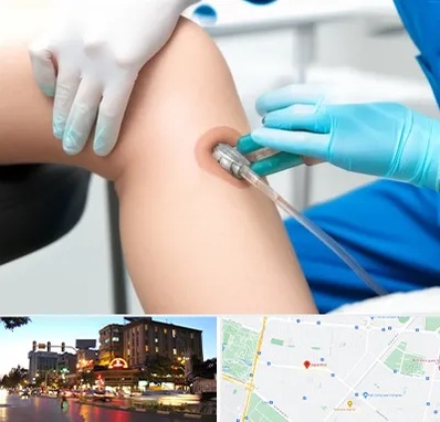 اوزون تراپی در بلوار سجاد مشهد 