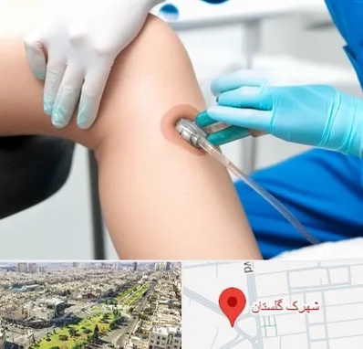 اوزون تراپی در شهرک گلستان