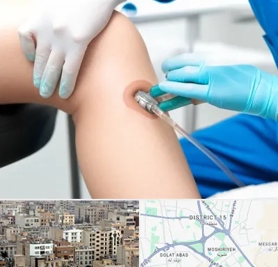 اوزون تراپی در جنوب شرق تهران