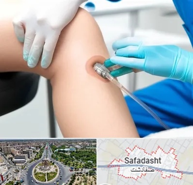 اوزون تراپی در صفادشت
