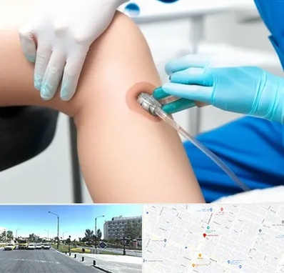 اوزون تراپی در بلوار کلاهدوز مشهد 