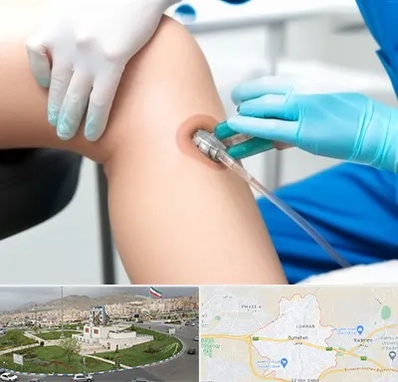 اوزون تراپی در بومهن