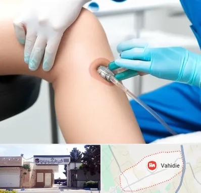 اوزون تراپی در وحیدیه شهریار