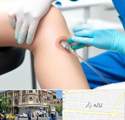 اوزون تراپی در لاله زار