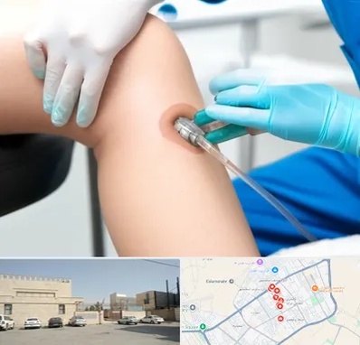 اوزون تراپی در نواب اسلامشهر 