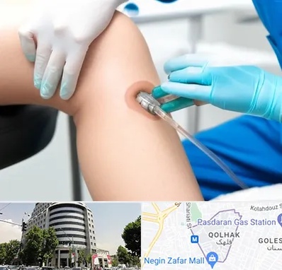 اوزون تراپی در قلهک 