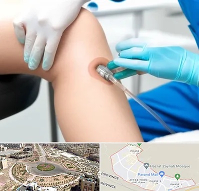 اوزون تراپی در پرند