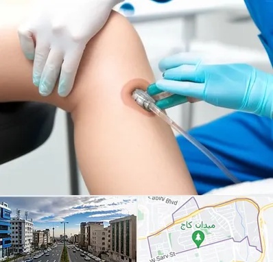 اوزون تراپی در سعادت آباد 