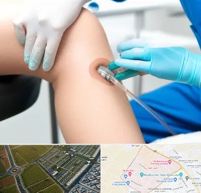 اوزون تراپی در الهیه مشهد 