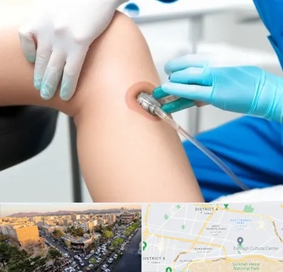 اوزون تراپی در تهرانپارس