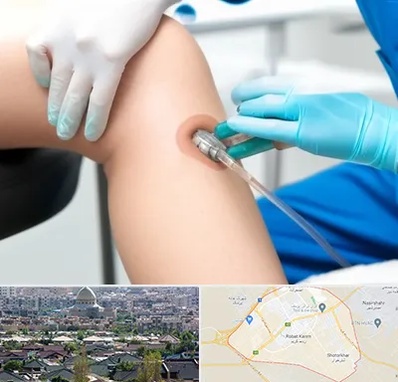 اوزون تراپی در رباط کریم