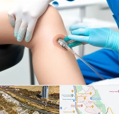 اوزون تراپی در خیابان نیایش شیراز 