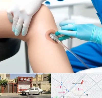 اوزون تراپی در باجک قم 